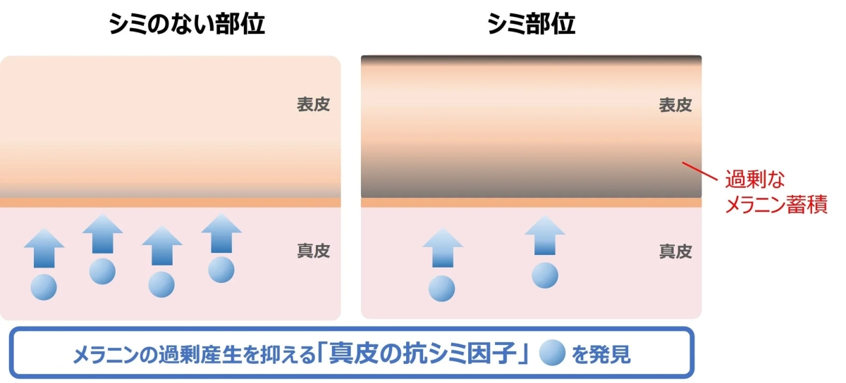 シミのない部位とシミ部位の皮膚構造比較図