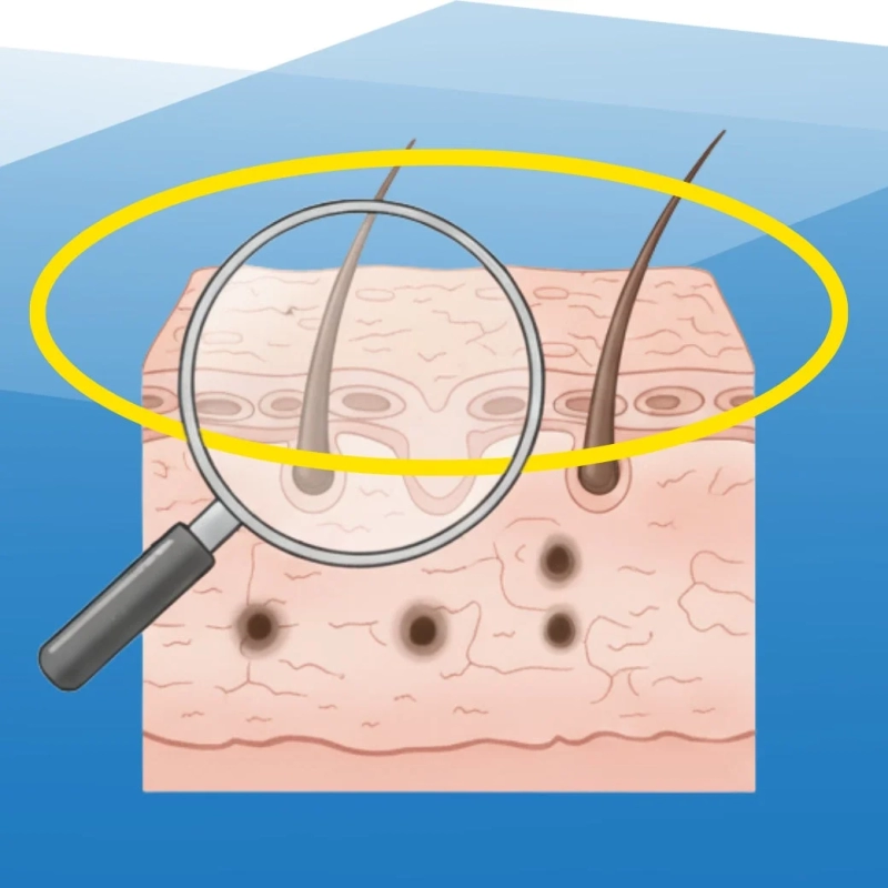 毛穴・黒ずみケア