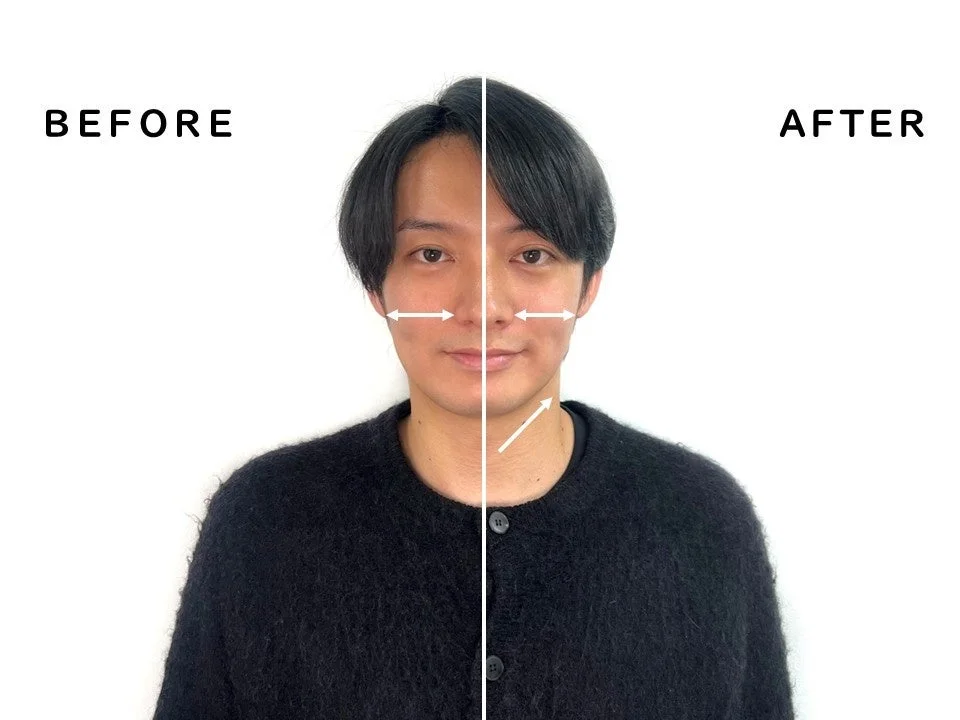 男性の顔のBEFOREとAFTERの比較
