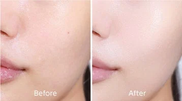 スキンケア製品使用前後の肌の比較